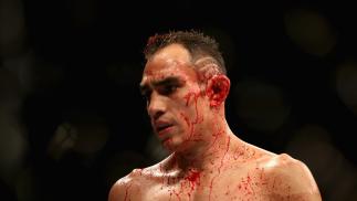 LAS VEGAS, NV - OCTOBER 06: Tony Ferguson looks on in his lightweight bout during the UFC 229 event inside T-Mobile Arena on October 6, 2018 in Las Vegas, Nevada. (Photo by Christian Petersen/Zuffa LLC/Zuffa LLC)