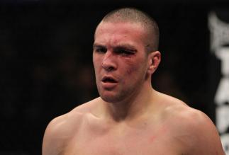 NASHVILLE, TN - JANUARY 20: Josh Neer reacts after defeating Duane Ludwig by submission during the UFC on FX event at Bridgestone Arena on January 20, 2012 in Nashville, Tennessee. (Photo by Josh Hedges/Zuffa LLC/Zuffa LLC via Getty Images)