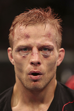 CALGARY, CANADA - JULY 21: Nick Ring looks on after defeating Court McGee after their middleweight bout at UFC 149 inside the Scotiabank Saddledome on July 21, 2012 in Calgary, Alberta, Canada. (Photo by Nick Laham/Zuffa LLC/Zuffa LLC via Getty Images)