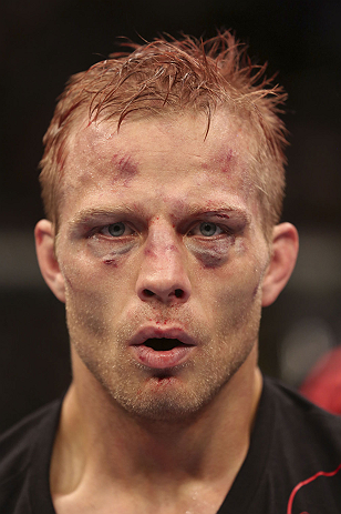 CALGARY, CANADA - JULY 21: Nick Ring looks on after defeating Court McGee after their middleweight bout at UFC 149 inside the Scotiabank Saddledome on July 21, 2012 in Calgary, Alberta, Canada.  (Photo by Nick Laham/Zuffa LLC/Zuffa LLC via Getty Images)