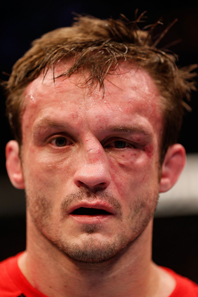BOSTON, MA - AUGUST 17: Brad Pickett reacts after his submission loss to Michael McDonald in their UFC bantamweight bout at TD Garden on August 17, 2013 in Boston, Massachusetts. (Photo by Josh Hedges/Zuffa LLC/Zuffa LLC via Getty Images)