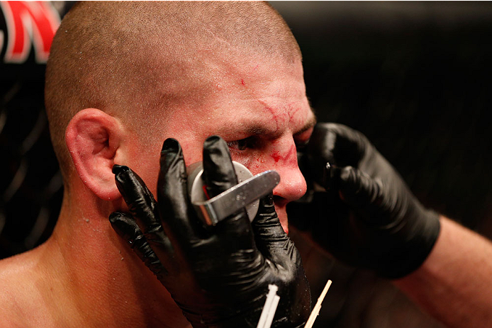 BOSTON, MA - AUGUST 17: Joe Lauzon is treated by a cutman after his decision loss to Michael Johnson in their UFC lightweight bout at TD Garden on August 17, 2013 in Boston, Massachusetts. (Photo by Josh Hedges/Zuffa LLC/Zuffa LLC via Getty Images)