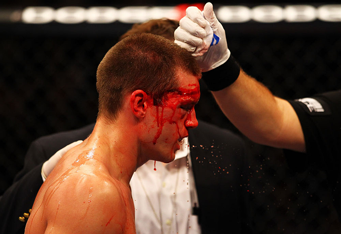 ATLANTA, GA - APRIL 21: Stephen Thompson recieves medical attention during his welterweight bout against Matt Brown for UFC 145 at Philips Arena on April 21, 2012 in Atlanta, Georgia. (Photo by Al Bello/Zuffa LLC/Zuffa LLC via Getty Images)