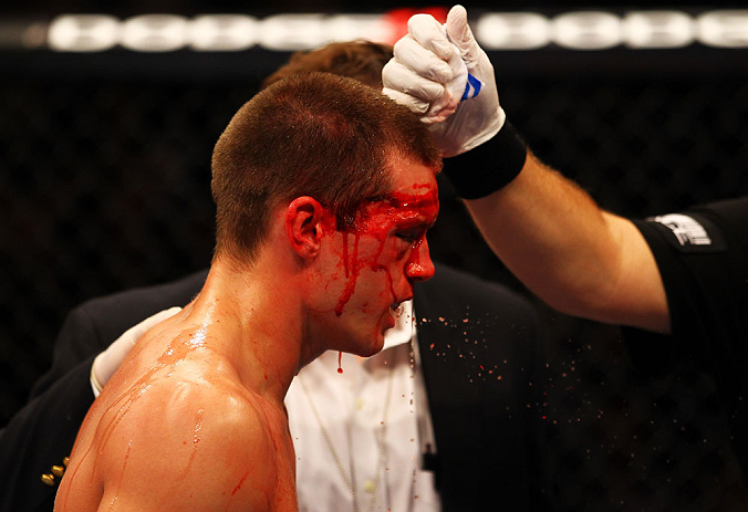 ATLANTA, GA - APRIL 21:  Stephen Thompson recieves medical attention during his welterweight bout against Matt Brown for UFC 145 at Philips Arena on April 21, 2012 in Atlanta, Georgia.  (Photo by Al Bello/Zuffa LLC/Zuffa LLC via Getty Images)