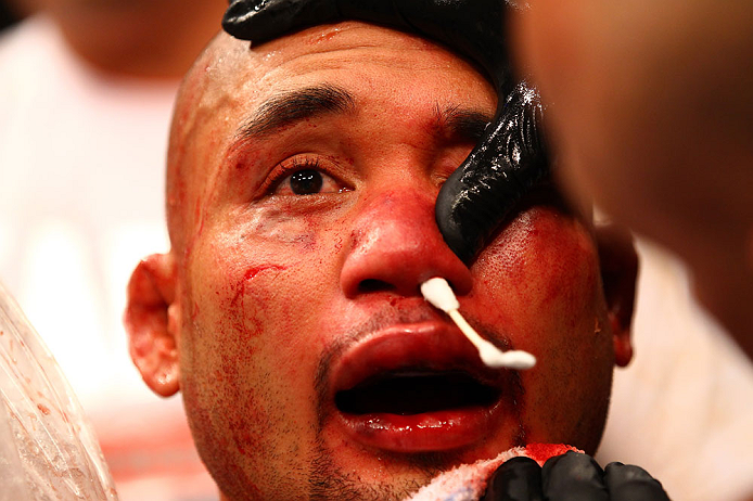ATLANTA, GA - APRIL 21: Eddie Yagin recieves medical attention after defeating Mark Hominick during their featherweight bout for UFC 145 at Philips Arena on April 21, 2012 in Atlanta, Georgia. (Photo by Al Bello/Zuffa LLC/Zuffa LLC via Getty Images)