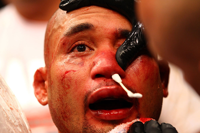 ATLANTA, GA - APRIL 21:  Eddie Yagin recieves medical attention after defeating Mark Hominick during their featherweight bout for UFC 145 at Philips Arena on April 21, 2012 in Atlanta, Georgia.  (Photo by Al Bello/Zuffa LLC/Zuffa LLC via Getty Images)