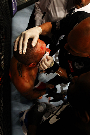 ATLANTA, GA - APRIL 21: Che Mills recieves medical attention during his welterweight bout against Rory MacDonald for UFC 145 at Philips Arena on April 21, 2012 in Atlanta, Georgia. (Photo by Al Bello/Zuffa LLC/Zuffa LLC via Getty Images)