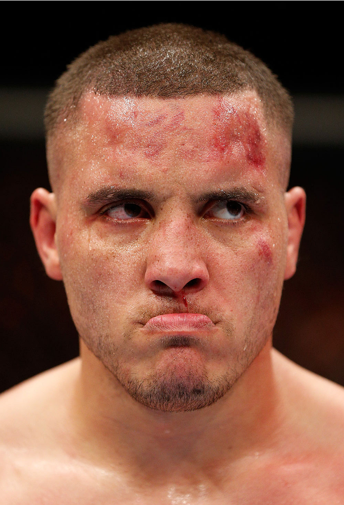 BRISBANE, AUSTRALIA - DECEMBER 07: Pat Barry reacts after his knockout loss to Soa Palelei in their heavyweight fight during the UFC Fight Night event at the Brisbane Entertainment Centre on December 7, 2013 in Brisbane, Australia. (Photo by Josh Hedges/