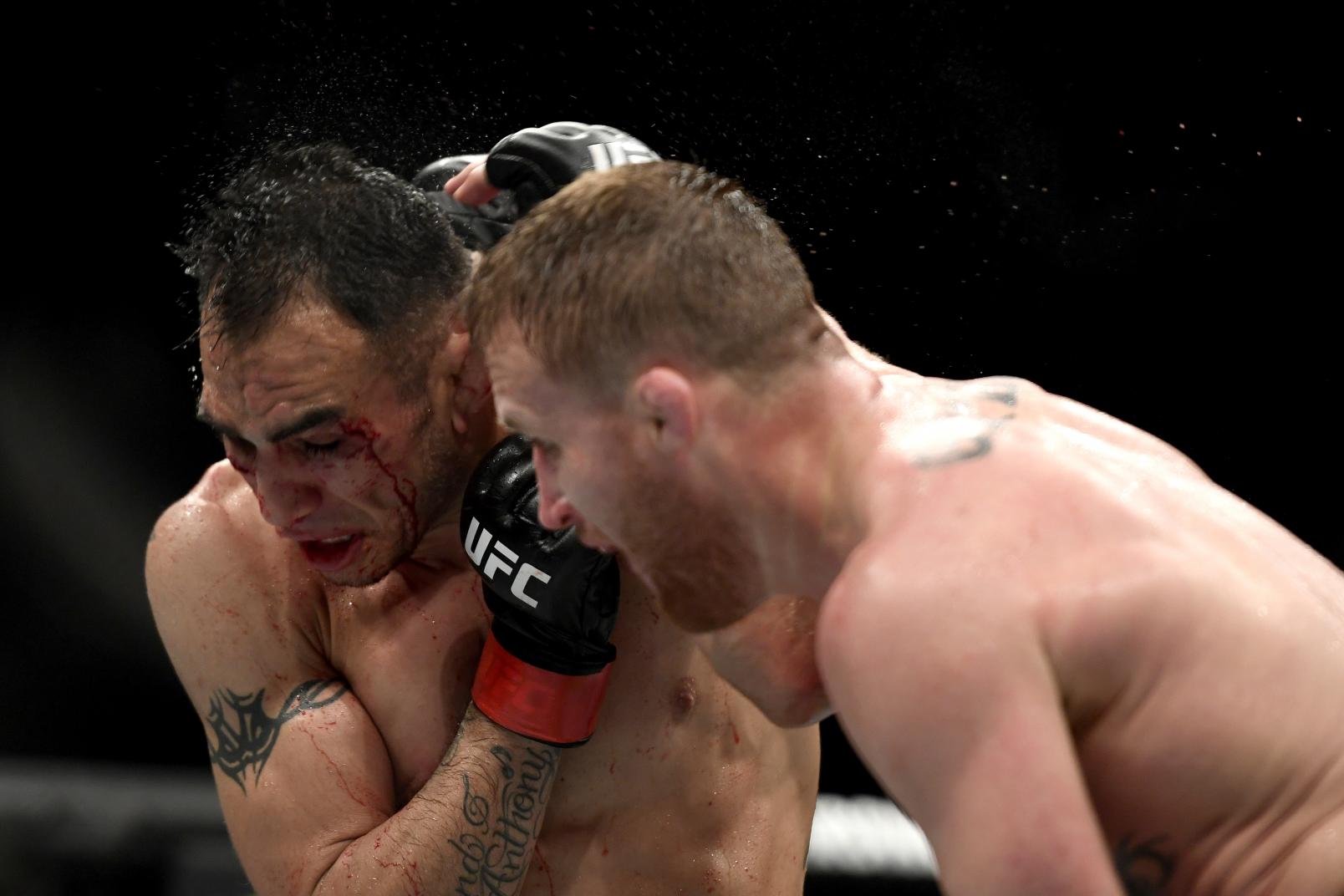 Justin Gaethje 2 CT